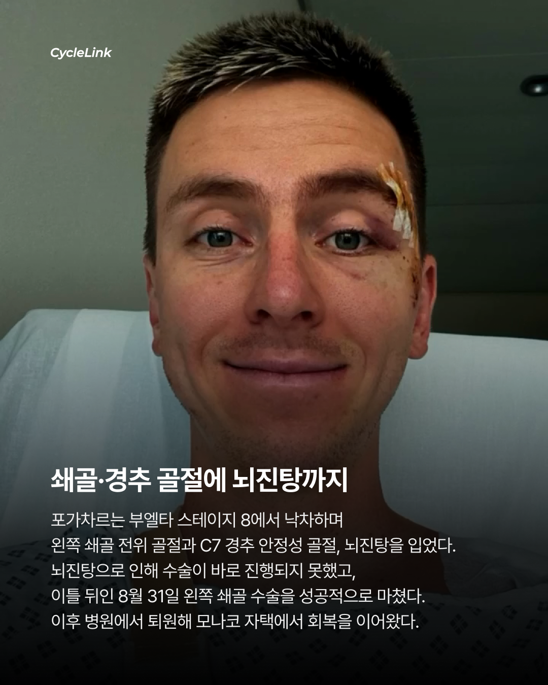 쇄골, 경추 골절 17일차 포가차르 훈련 복귀 · 사진 3