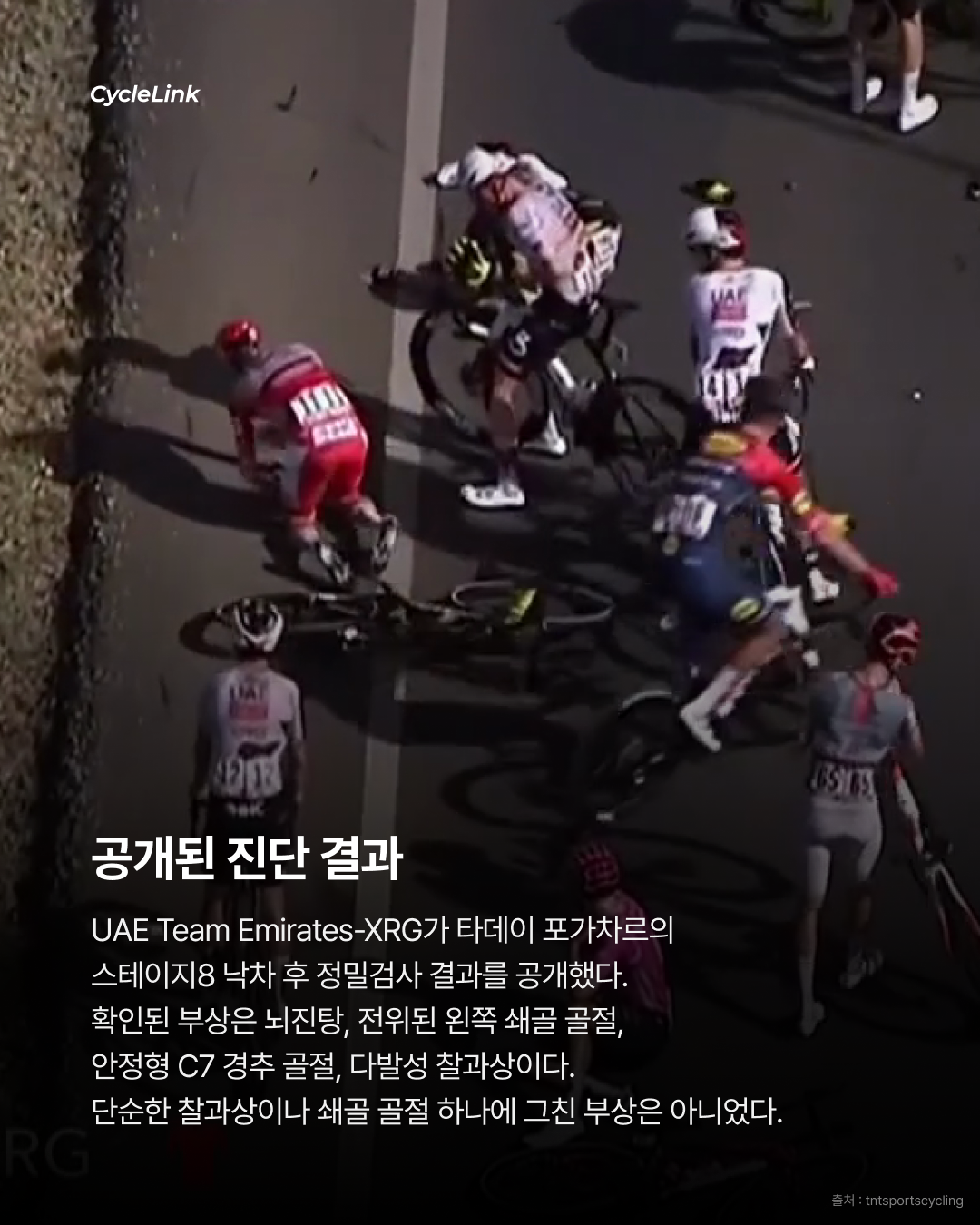 쇄골, 경추 골절까지 포가차르, 심한 부상 상태 · 사진 2