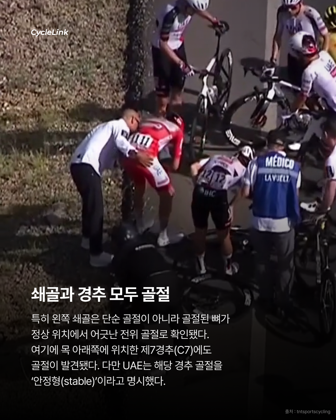 쇄골, 경추 골절까지 포가차르, 심한 부상 상태 · 사진 3